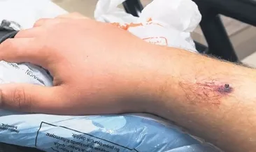 İllüzyonist Aref’i kobrası ısırdı