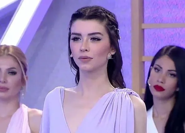İşte Benim Stilim yarışmacısı Aleyna Eroğlu estetikle tanınmaz hale geldi! Sana ne olmuş böyle