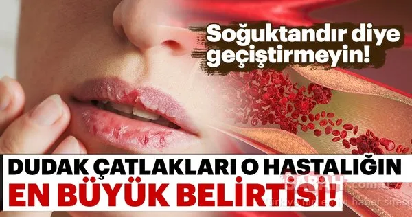 kansizlik belirtileri nelerdir iste