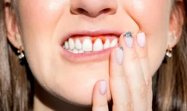 Hem dişlerinizi hem sağlığınızı tehdit ediyor! Diş eti kanamalarına dikkat