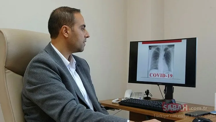 Türk mühendisten Kovid-19 teşhisi için önemli çalışma! Röntgen filmlerinden koronavirüsü böyle teşhis ediyor!