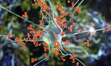 Dünyanın en garip 5 hastalığı