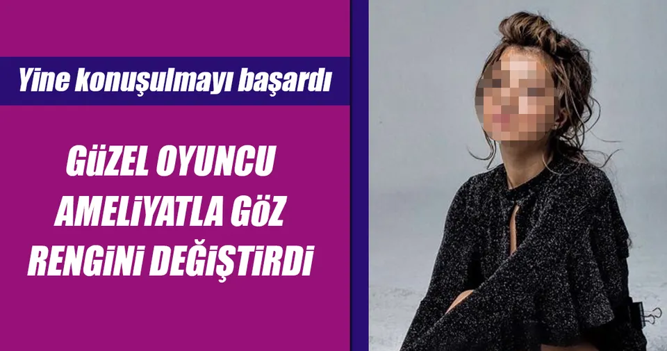 Buse Narci Nin Goz Rengi Gercek Mi Magazin Haberleri