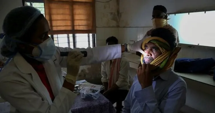 Hindistan’da yeni salgın: Kara mantar! Bazı hastalar ancak tek gözleri alınırsa iyileşiyor