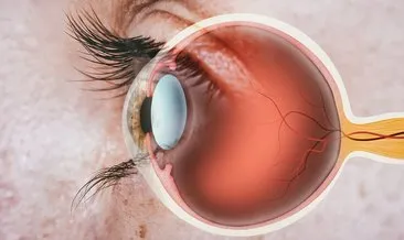 Retina Nedir? Göz Bölümlerinden Retina Ne İşe Yarar, Hastalıkları Neler Ve İyileşir Mi?