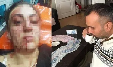 Kendisini bıçaklayan eski eşine çocuklarını göstermediği için cezaevine girdi #ankara