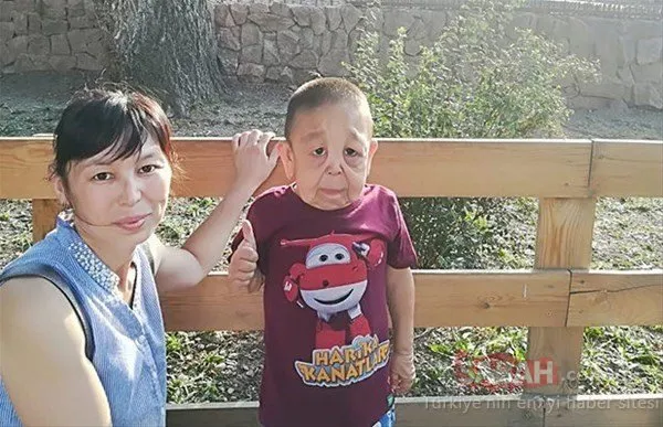 Dünyanñn en tuhaf hastalñklarñ