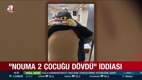 Beşiktaş'ın eski yıldızı Pascal Nouma 2 çocuğu dövdü iddiası | Video
