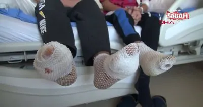 Erzincan’da taşıdıkları demir yüksek gerilim hattına temas eden çocukların ayak tabanları patladı | Video