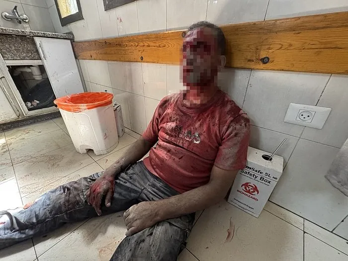 SON DAKİKA | Katil İsrail Gazze’de hastaneyi bombaladı! Kan donduran görüntüler: Çok sayıda ölü ve yaralı var