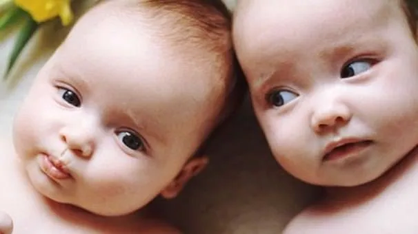 İkiz bebekleri birbirinden ayırt eden özellikler
