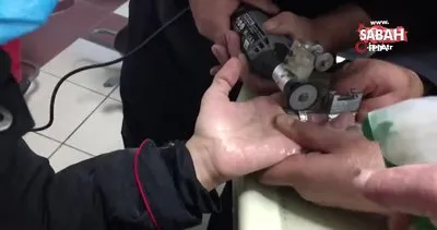 Kayseri’de itfaiyenin parmağı kangren olmaktan kurtaran yüzük operasyonu kamerada | Video