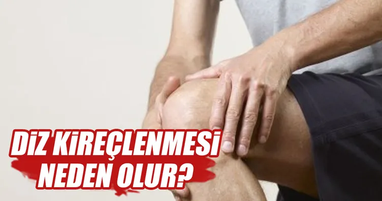 Diz kireçlenmesi nasıl tedavi edilir?