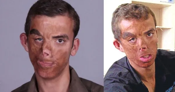 Yeni yüzü, yeni yaşamı ve son haliyle Uğur Acar