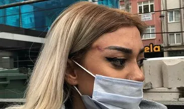 Son dakika haberi! Genç kadın estetik kurbanı oldu! Yüzünde hasarlar oluştu!