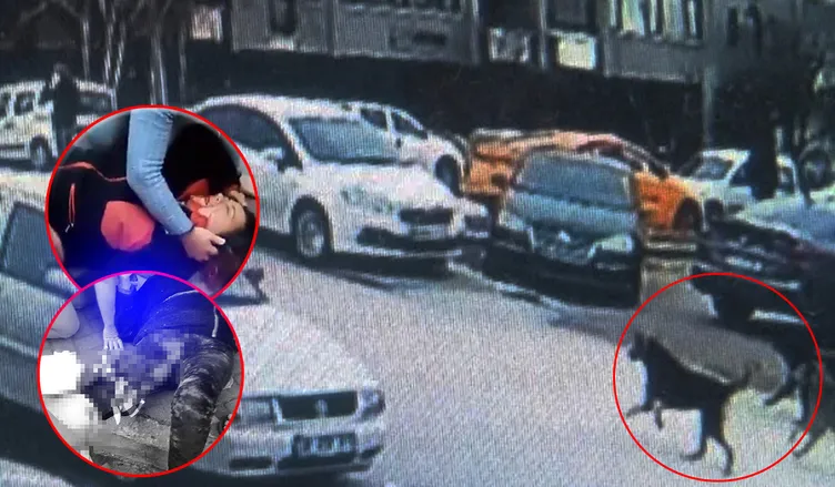 Başıboş köpeklerin saldırısına uğrayan akademisyen Meliha Yılmaz korku dolu anları anlattı: Her biri bedenimden parçalar koparmaya başladı…