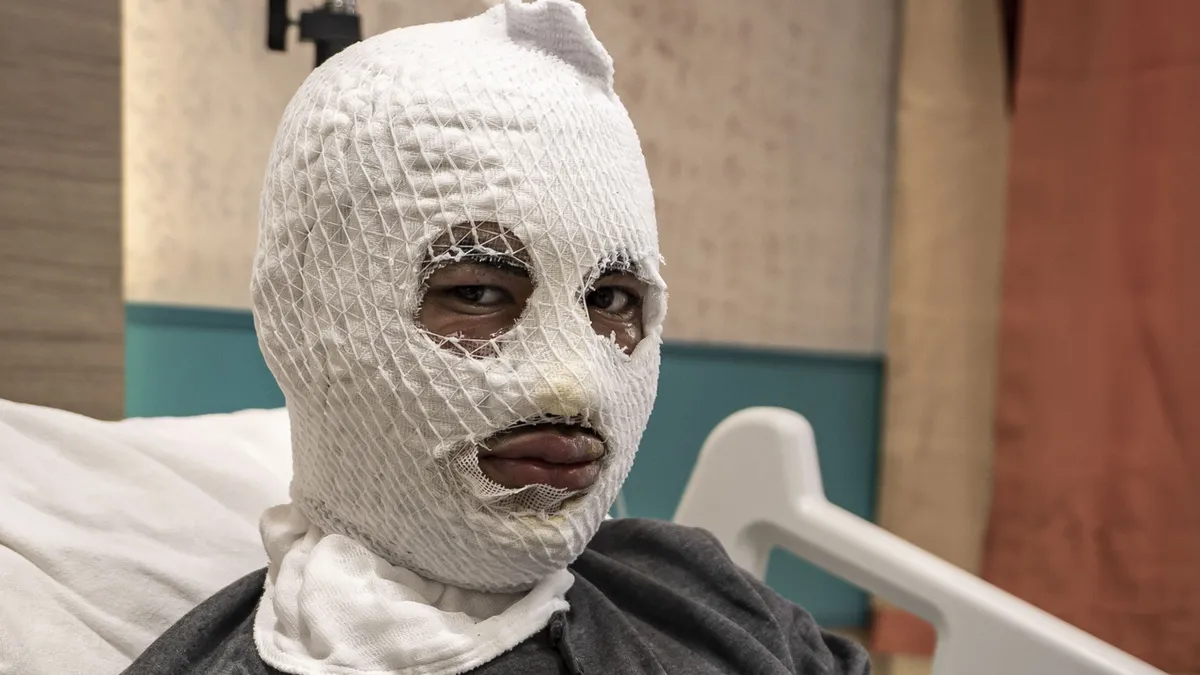 Çakmağına doldurduğu gaz az kalsın öldürüyordu: Ben yandım, başkaları yanmasın Çakmağına doldurduğu gaz az kalsın öldürüyordu: Ben yandım, başkaları yanmasın