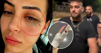 Türk kızı Asya Karaali’ye ırkçı saldırı: Türkçe konuştuğunu duyunca öyle şeyler yaptılar ki...