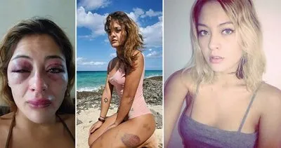 Korkunç olay! Sevgilisi güzel model Sonia Rodriguez’e vahşice saldırdı