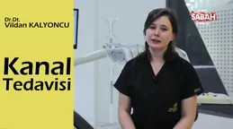 Kanal tedavisi nedir? Nasıl yapılır?