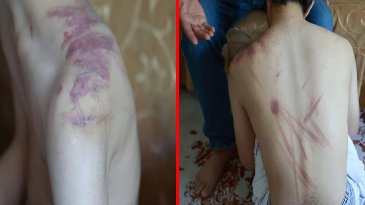 Elazığ’da kan donduran olay: 14 yaşındaki engelli çocuğa şiddet… Acılı baba soluğu adliyede aldı Elazığ’da kan donduran olay: 14 yaşındaki engelli çocuğa şiddet… Acılı baba soluğu adliyede aldı