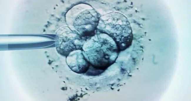 Tup Bebek Skandalinda Mahkeme Kararini Verdi Son Dakika Haberler