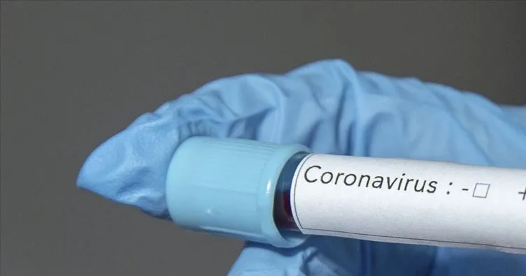 Son Dakika: Dünyada koronavirüs bulaşan kişi sayısı 85 bini aştı