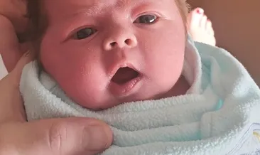 Neden bazı bebekler saçlı, bazıları saçsız doğar?