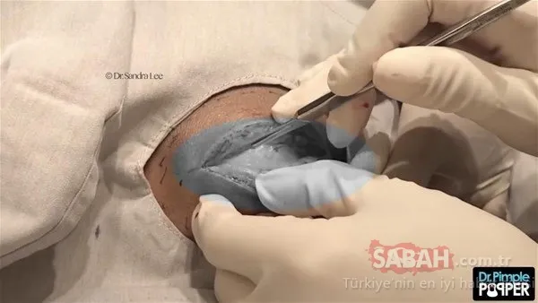 Doktora bu halde geldi! Sonrasındaysa...