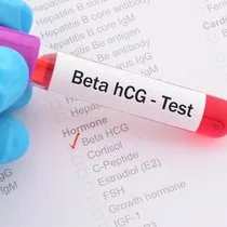 Beta HCG Haberleri - Son Dakika Beta ...
