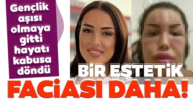 Son Dakika Bir Estetik Faciasi Daha Genclik Asisi Yaptirmaya Gitti Hayati Kabusa Dondu Son Dakika Haberler