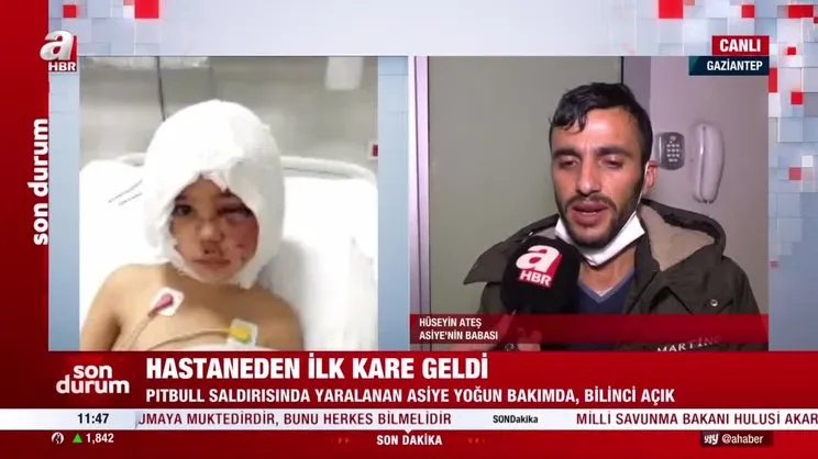 SON DAKİKA: Gaziantep'te pitbull saldırısına uğrayan minik Asiye'nin babası konuştu! İşte hastaneden ilk kareler... | Video