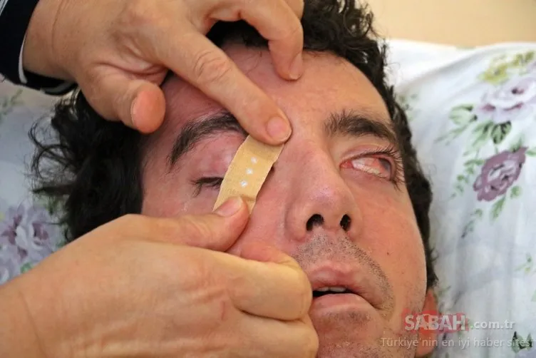 Son Dakika Haberi: Göz kapaklarını kırpamıyor! SSPE hastası olan Halil Özelik gözlerini yara bandı ile bile kapatamadı