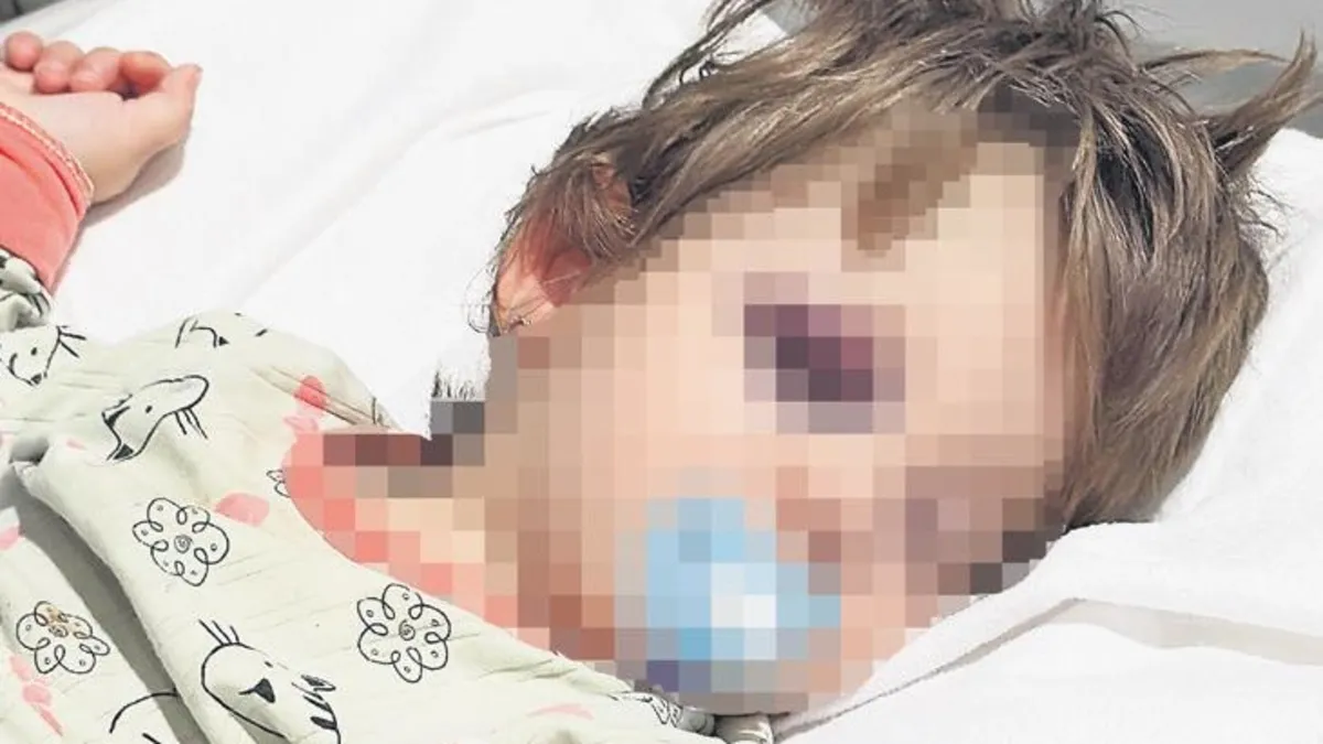 Baba ve 14 aylık kızına vahşi saldırı