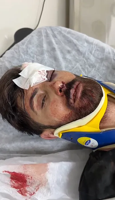 Tek yumrukla komalık olmuştu: Eşref Yunus Yıldırıcı hayatını kaybetti!