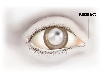 100'den fazla hastalığa iyi gelen bitki