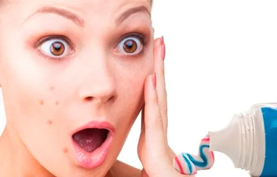 sivilceye dis macunu surmek zararli mi dis macunu sivilce gecirir mi etkisi nedir saglik haberleri