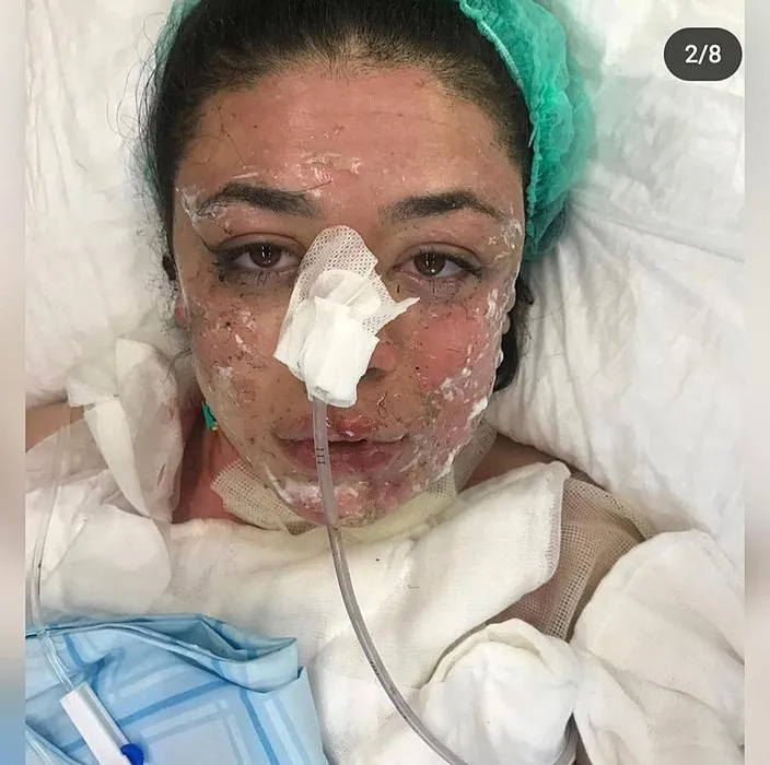 Gizem Hemşire hastanedeki dehşeti anlattı: Yakayım mı sizi dedi ve...