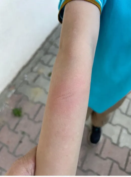 SON DAKİKA... İstanbul’da 7 yaşındaki çocuğa demir çubuklu dayak: Oğlun çok ağlıyor okula gel!