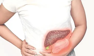 Karaciğerimiz yağlı