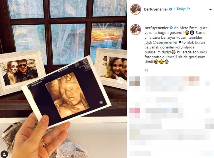 Berfu Yenenler bebeğinin ultrason görüntülerini paylaştı