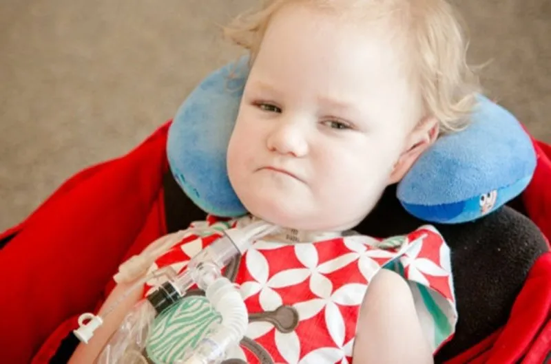 belirtileri nelerdir