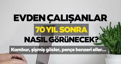 Evden çalışanlar 2100 yılında nasıl gözükecek? İşte kambur srtı, kararmış ve çökmüş gözaltları, varisli bacakları ile model Anna...