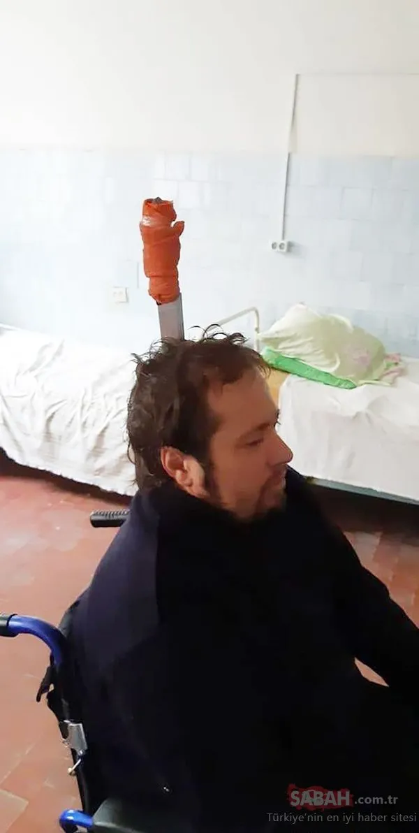 Polisler şoke oldu! Nefes almak için kafasına bıçak sapladı