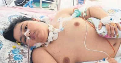 Furkan yürümek istiyor