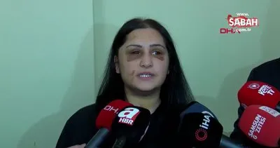 Samsun’da İbrahim Zarap’ın öldüresiye dövdüğü eski eşi Emriye Metoğlu’ndan açıklama | Video