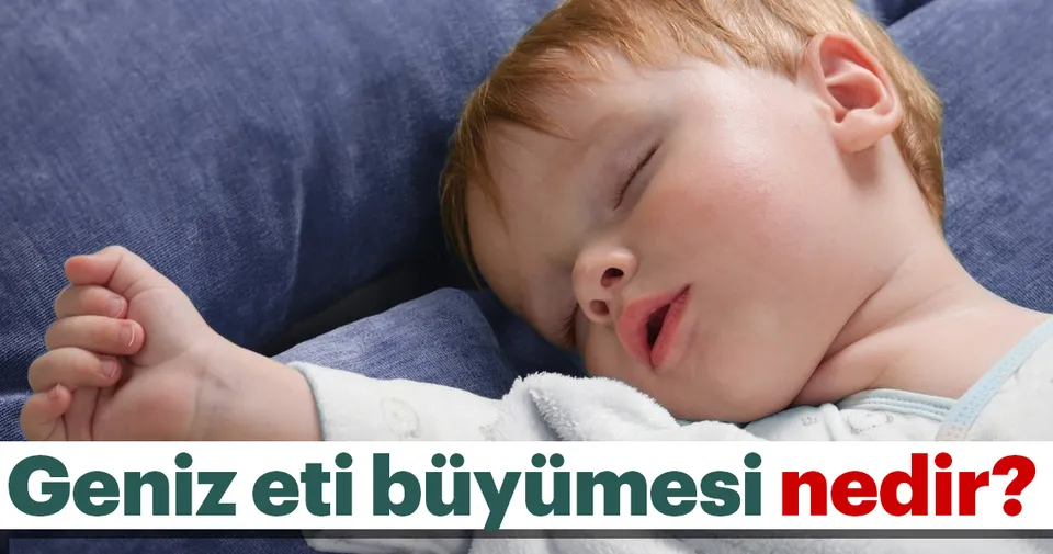 Geniz eti büyümesi tehlikeli midir? Sağlık Haberleri