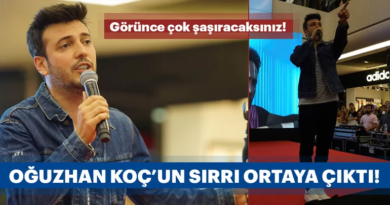 Protez saç kullanan ünlü isimler