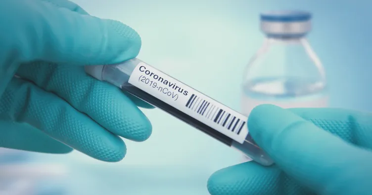 site:sabah.com.tr coronavirüs ile ilgili görsel sonucu