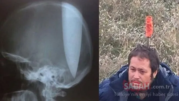 Polisler şoke oldu! Nefes almak için kafasına bıçak sapladı